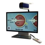 Téléagrandisseur ONYX Deskset HD